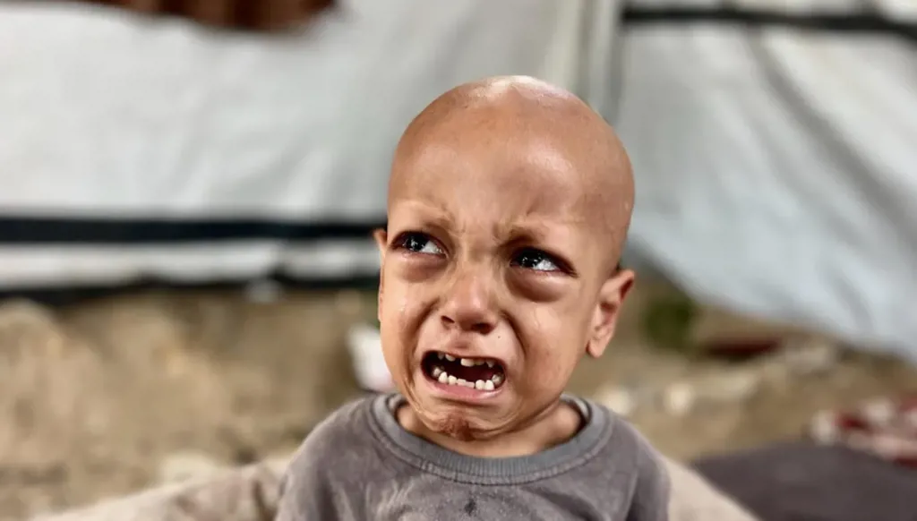 حزن وغضب يجتاح المنصات إثر وفاة الطفل الغزي صاحب قولة “أنا جوعان”
